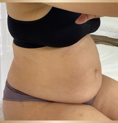 Biomē Ice transformação antes